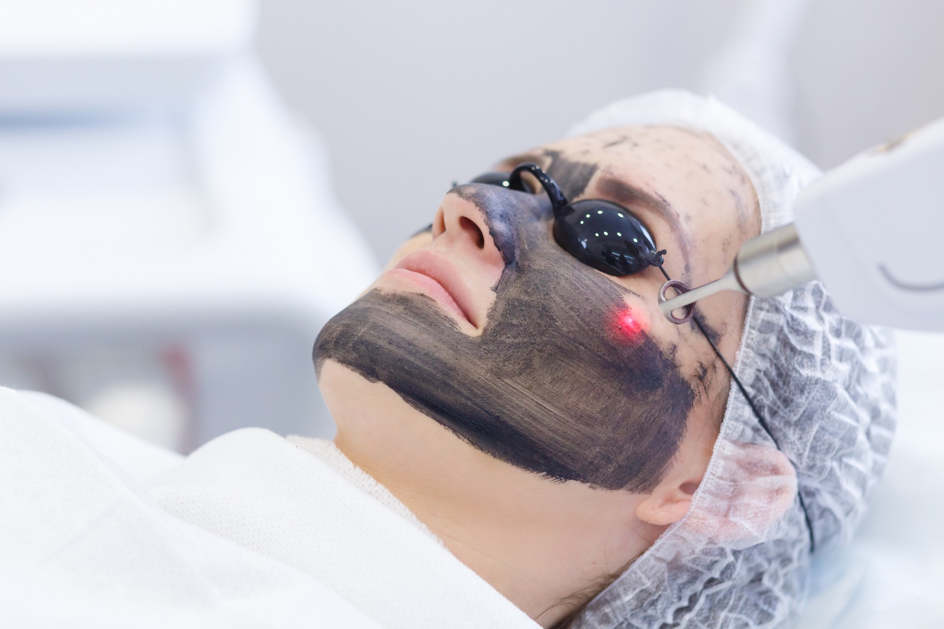 Hollywood Laser Peel in action