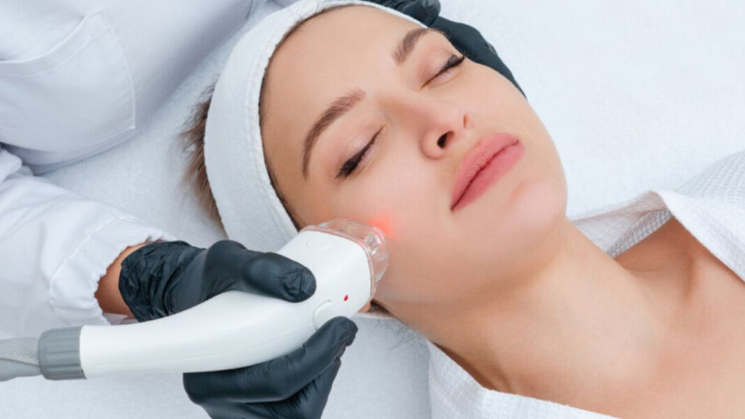 Q-Switch Laser Facial Treatment